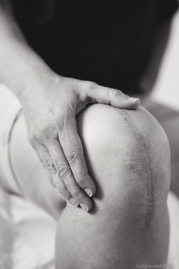 Holly Anissa Photography right knee replacement